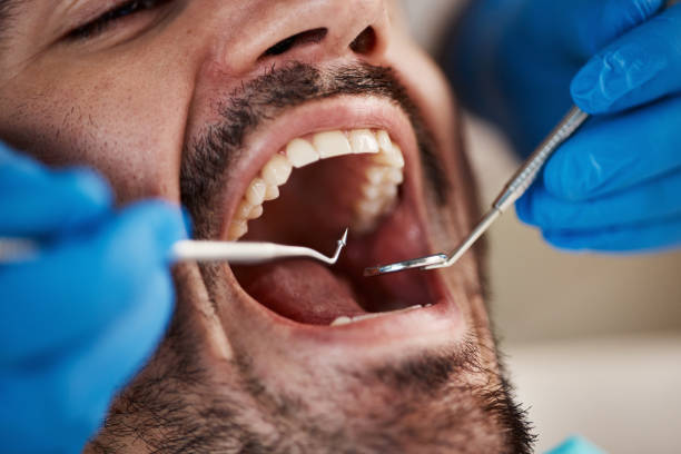Best Cracked Tooth Emergency Dentist  in San Leandro, CA